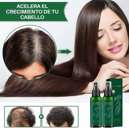 TÓNICO CAPILAR OUHOE - Crece y Fortalece tu Cabello