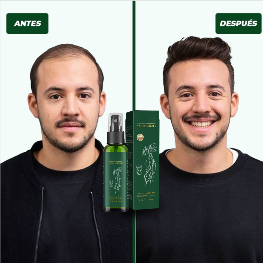 TÓNICO CAPILAR OUHOE - Crece y Fortalece tu Cabello