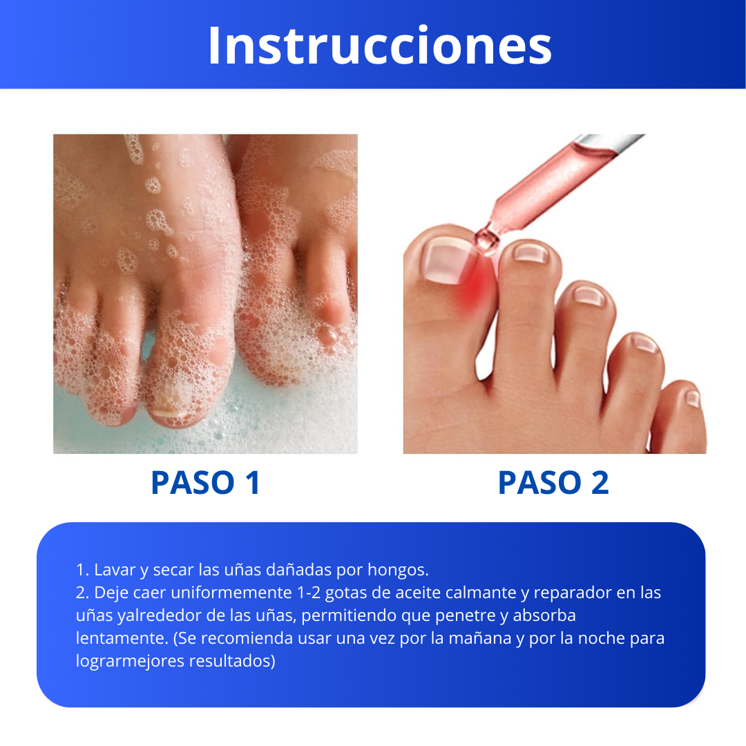 Anti Hongo Toenailplus Elimina Hongos